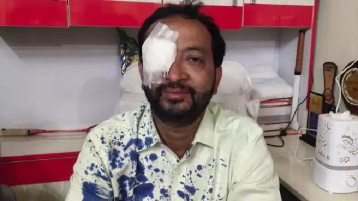 पुष्पम प्रिया चौधरी की प्लुरल्स पार्टी के प्रत्याशी पर हमला, आंख में लगी चोट